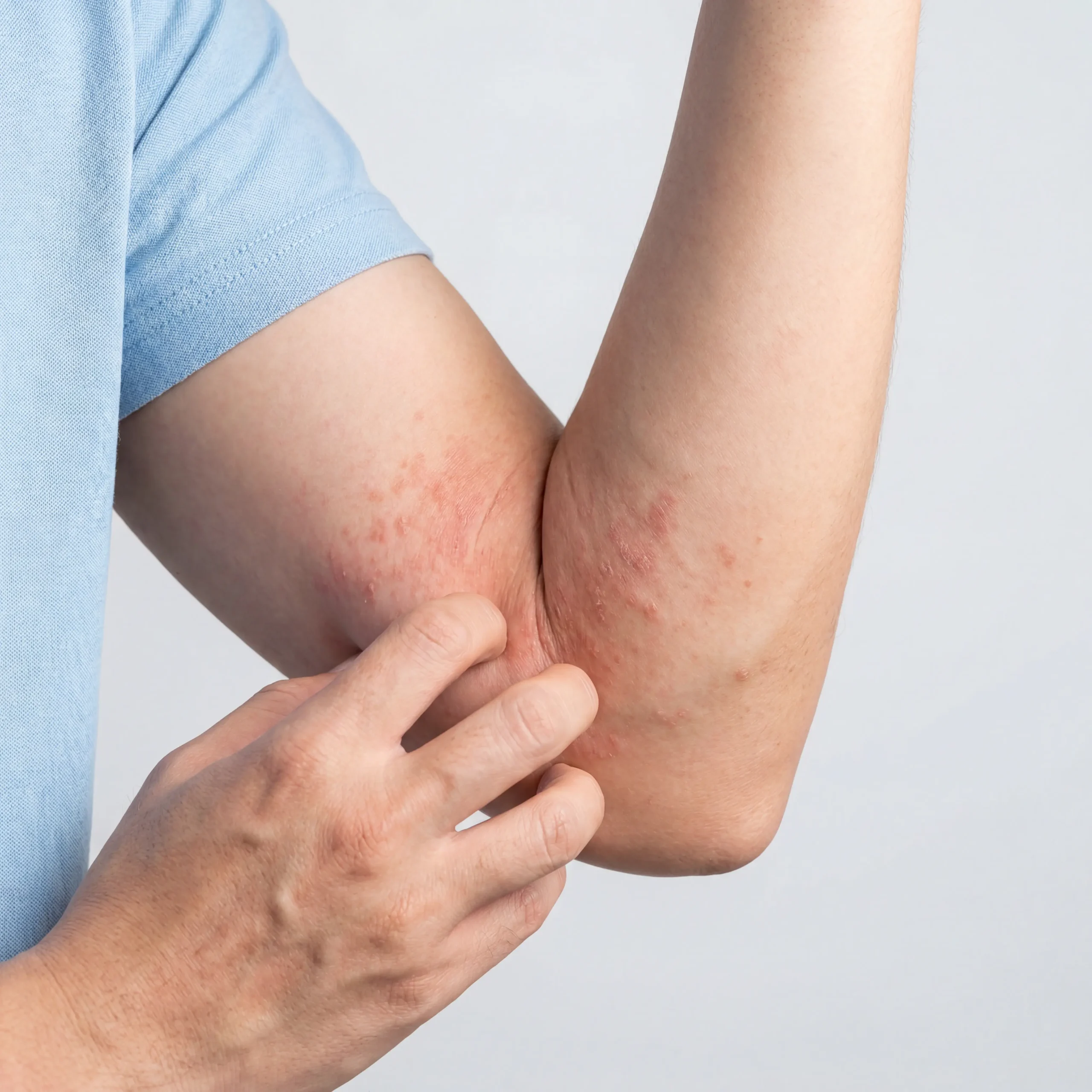 Itchy skin icon
